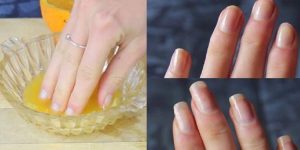 dicas para fazer as unhas crescer rápido