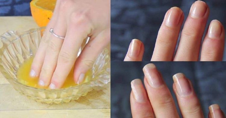 dicas para fazer as unhas crescer rápido