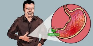 causas, sintomas e tratamentos de gastrite