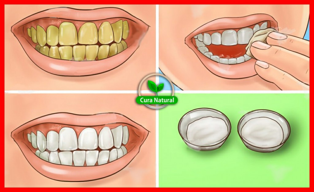 remédio caseiro para clarear os dentes