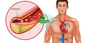receita caseira para baixar o colesterol
