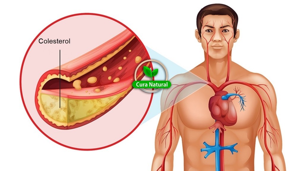 receita caseira para baixar o colesterol