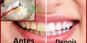 clarear dentes amarelos