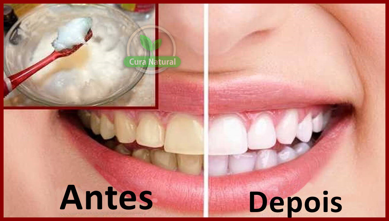 clarear dentes amarelos