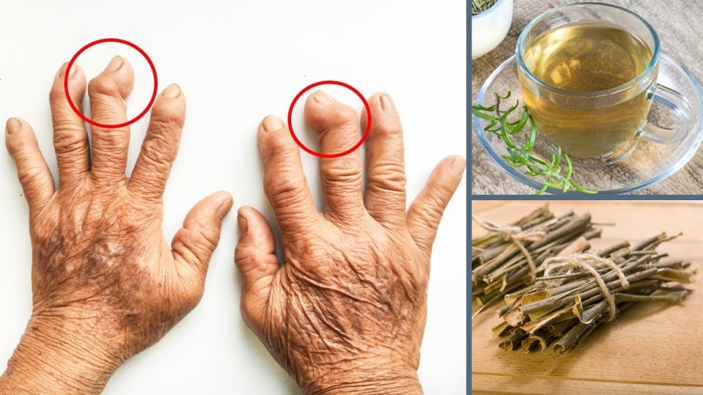 artrite remedio caseiro