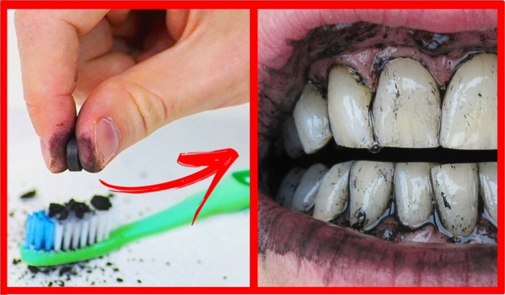 formas de usar carvao ativado para clarear os dentes