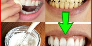 bicarbonato de sodio para clarear os dentes