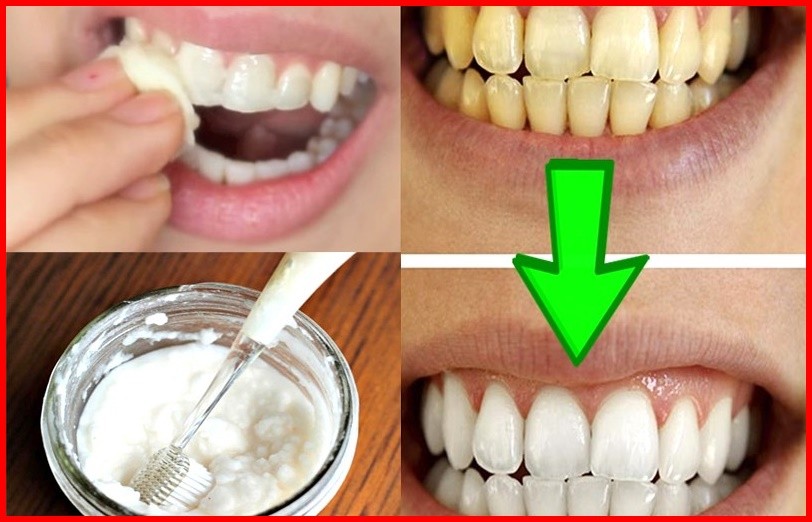 bicarbonato de sodio para clarear os dentes
