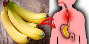 benefícios da banana para refluxo ácido