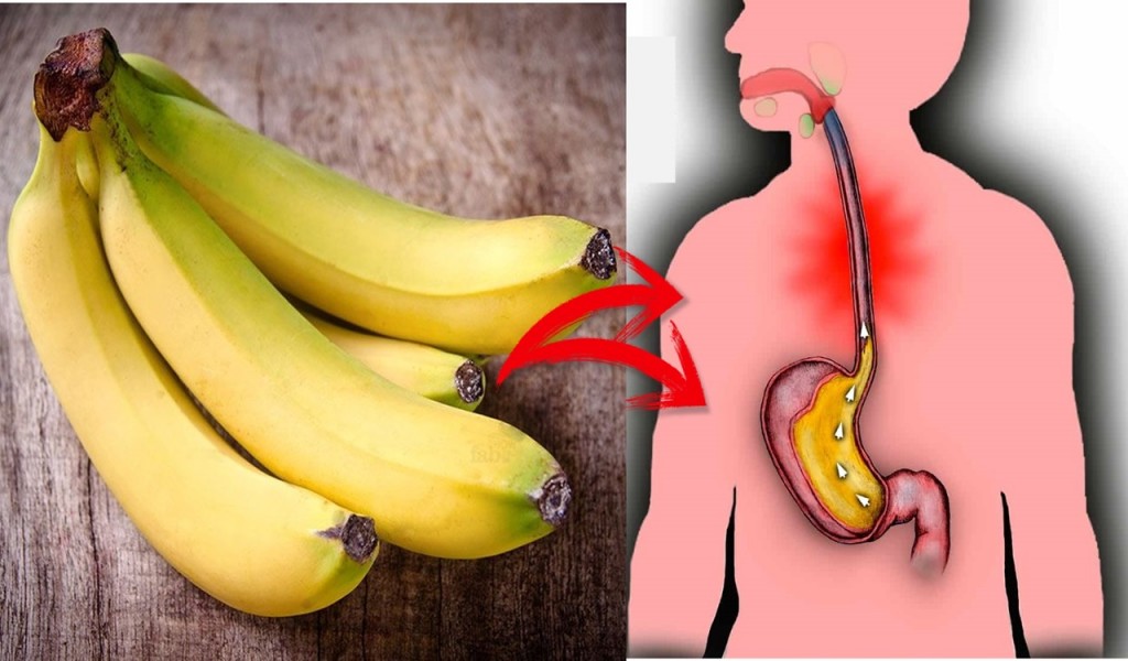 benefícios da banana para refluxo ácido