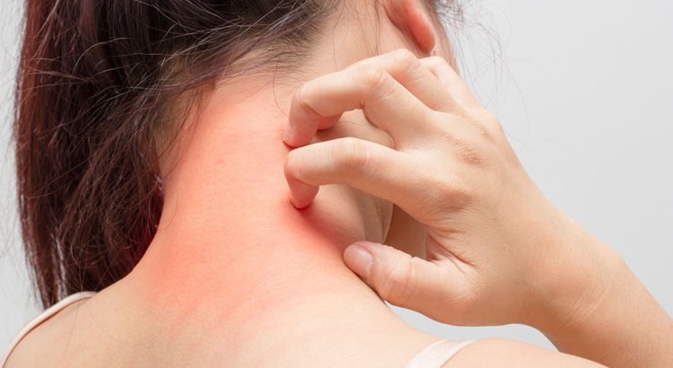 Dermatite de contato: o que é, causas, sintomas e tratamentos