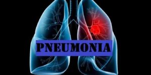 pneumonia