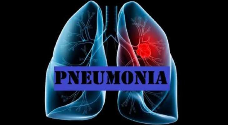 pneumonia