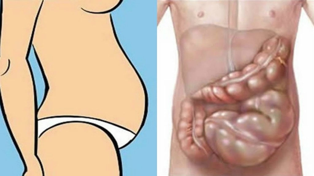 remedios para reduzir o inchaco abdominal