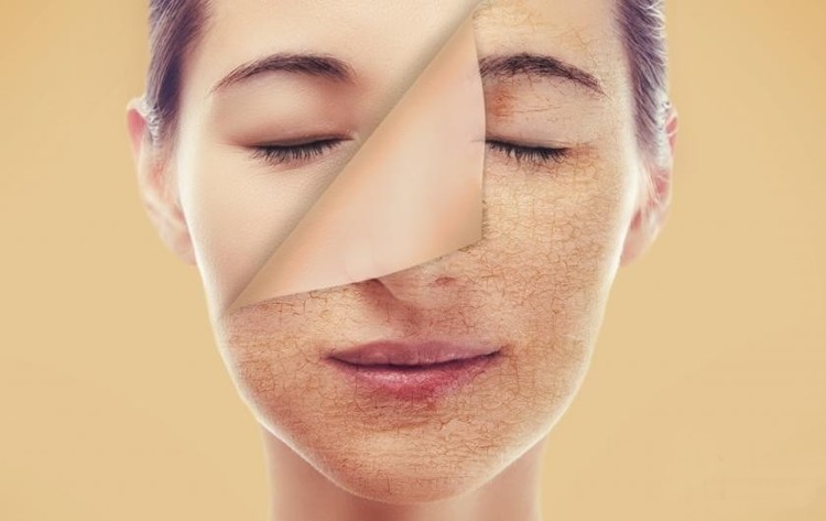Remédios caseiros para ter uma pele clara: como usar, dica e receitas