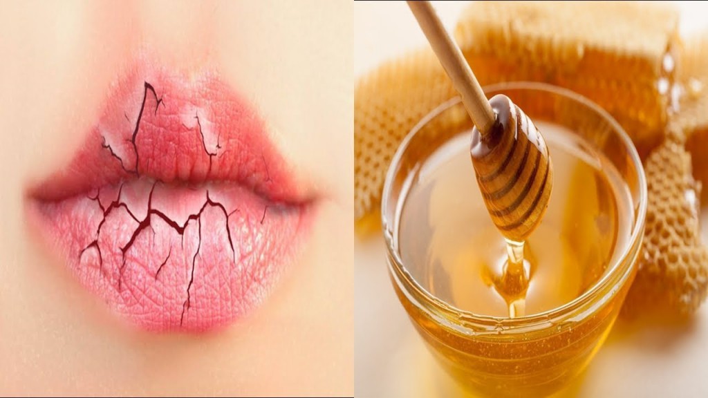 tratamentos naturais para labios rachados