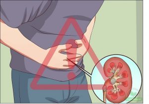 Cálculo renal: o que é, causas, tratamento e prevenção