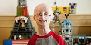 causas da progeria