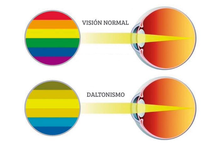 Daltonismo: o que é, causas, sintomas e tratamentos