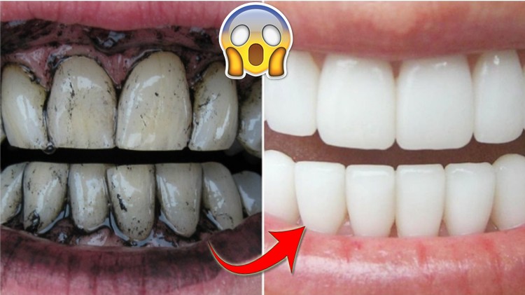 remédios caseiros para clarear os dentes naturalmente