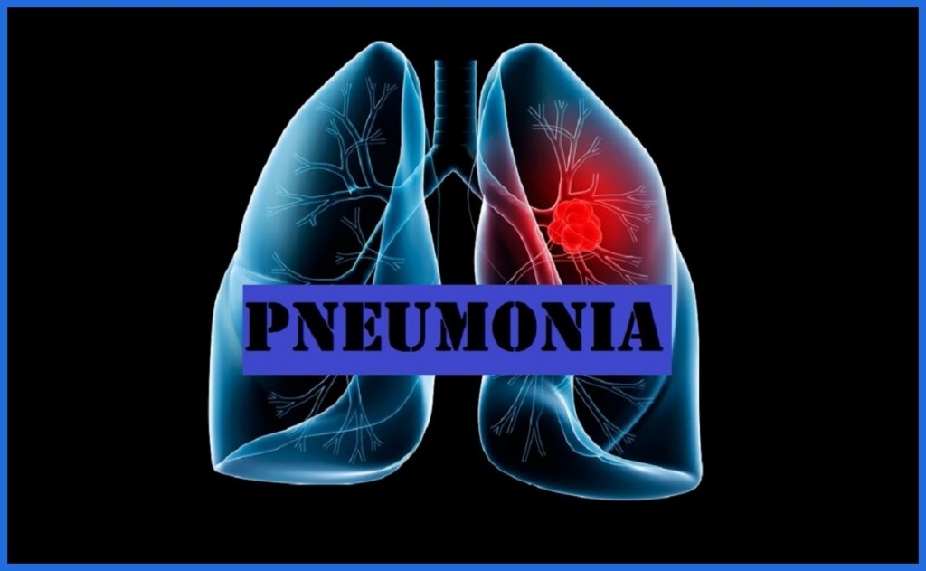 combater pneumonia