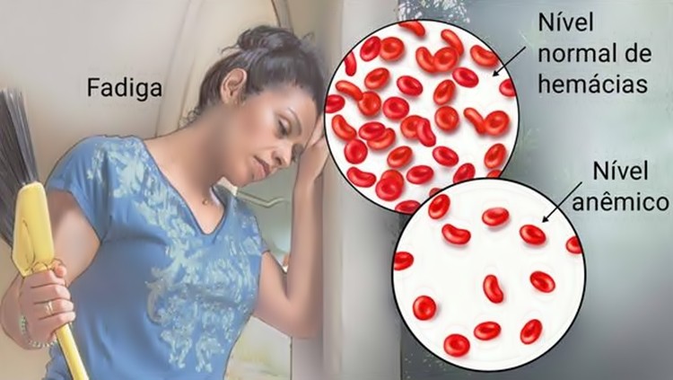 como acabar com a anemia de forma natural?