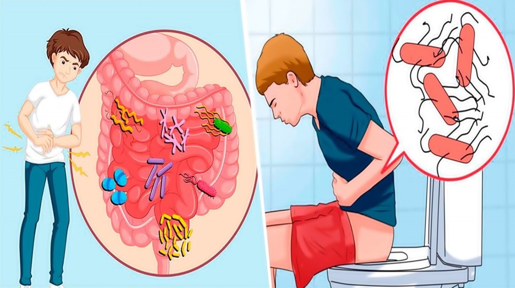 como tratar a infecçao intestinal naturalmente