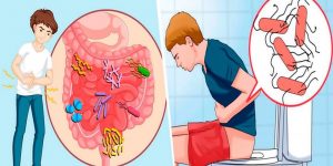 como tratar a infecçao intestinal naturalmente