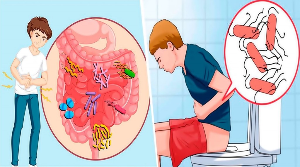 Como tratar a infecção intestinal naturalmente: dicas e receitas