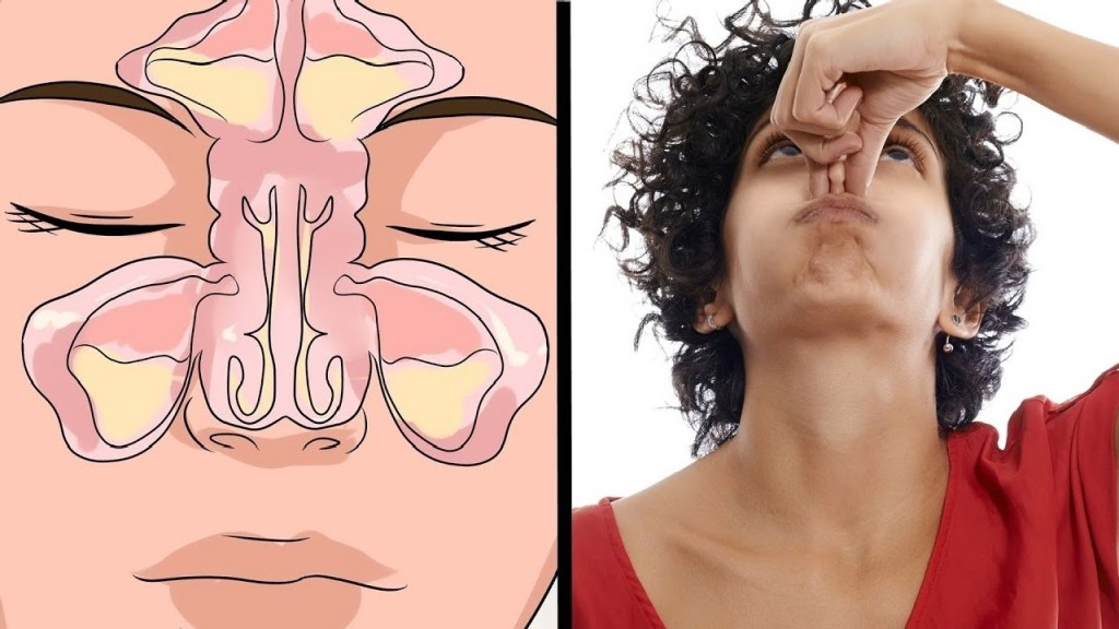 10 remédios caseiros para acabar com a congestão nasal