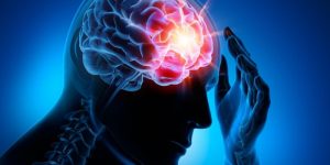 Epilepsia: O que é, Causas e Como Prevenir