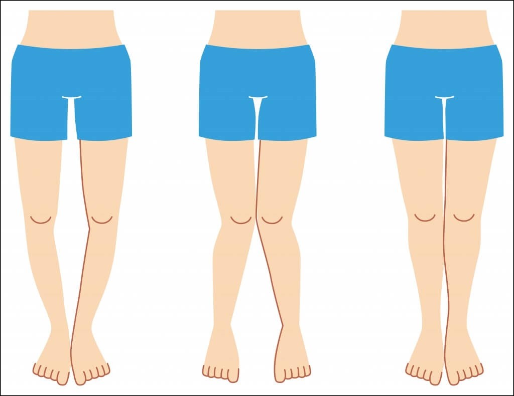 Deficiência de vitamina D: causas, sintomas e tratamentos