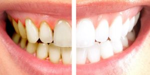 ter dentes brancos e saudáveis