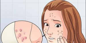 receitas com sal de epsom para eliminar acne