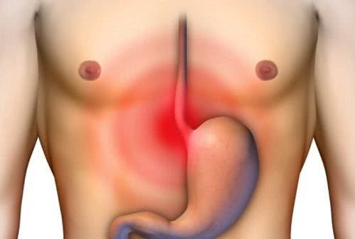 sintomas e tratamentos para os tipos de esofagite