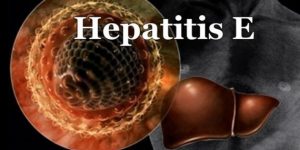 hepatite E
