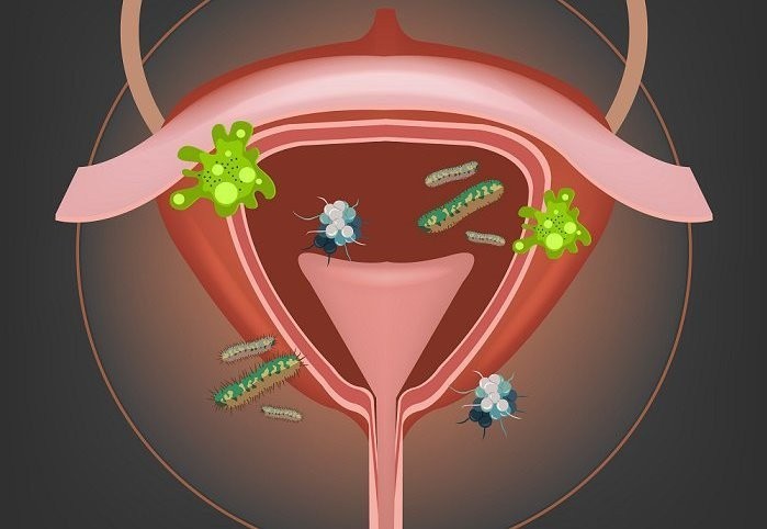 infecçao urinaria