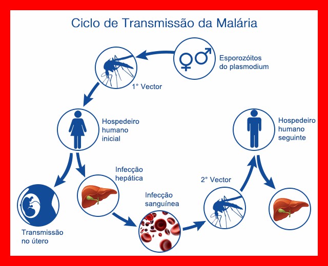 Malária: o que é, sintomas e prevenção