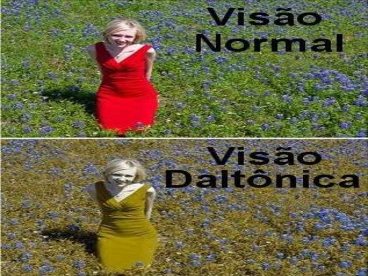 Daltonismo: o que é, causas, sintomas e tratamentos