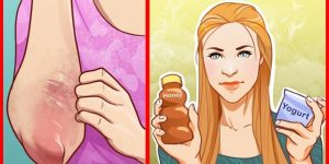 remedios caseiros para combater a pele seca