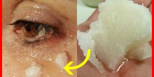 receita caseira para eliminar as rugas nos olhos