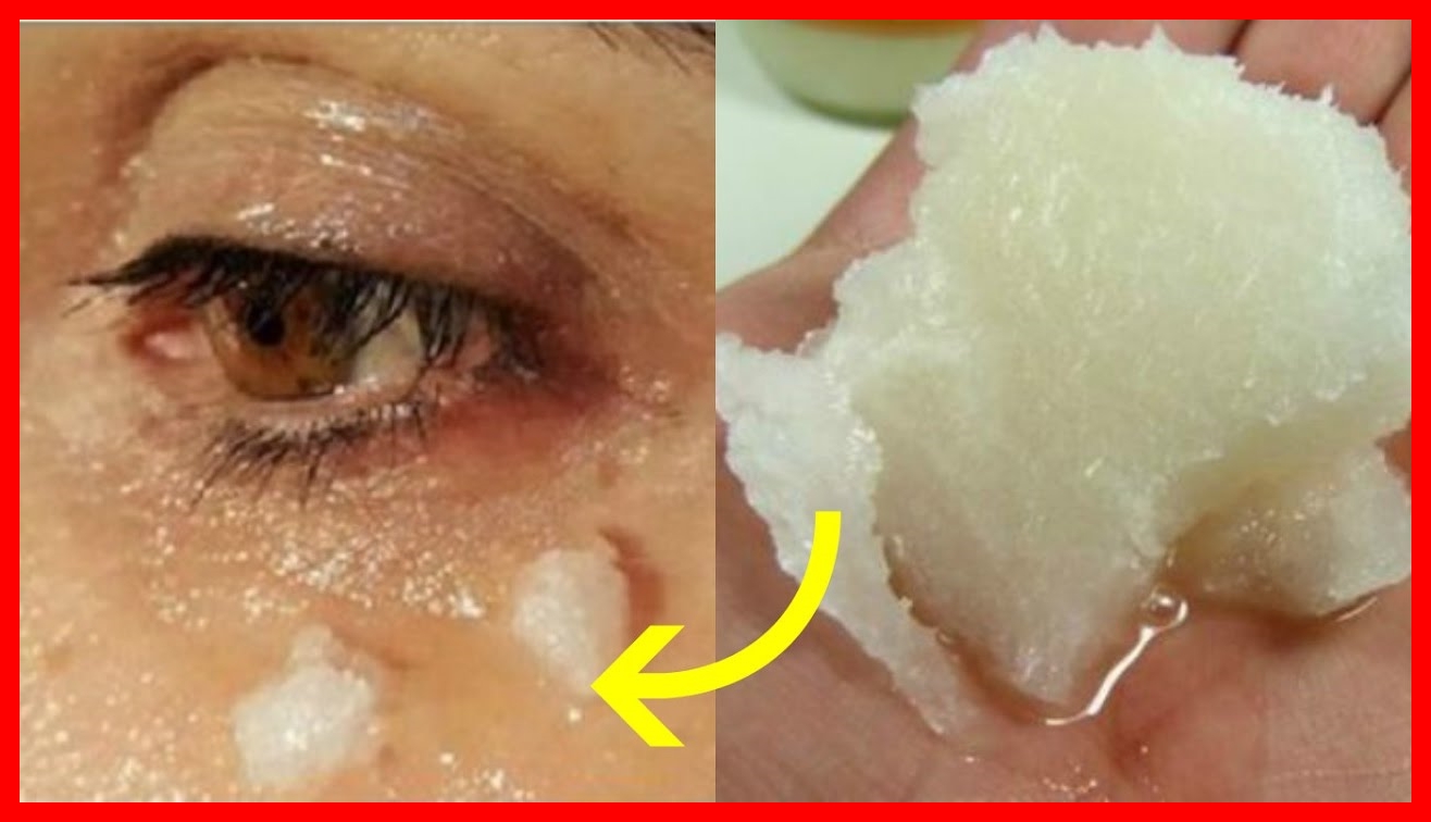 receita caseira para eliminar as rugas nos olhos