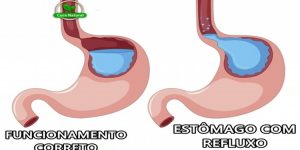 como acabar com o refluxo naturalmente