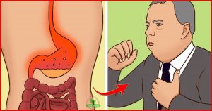 3 dicas para tratar o refluxo ácido naturalmente: passo a passo