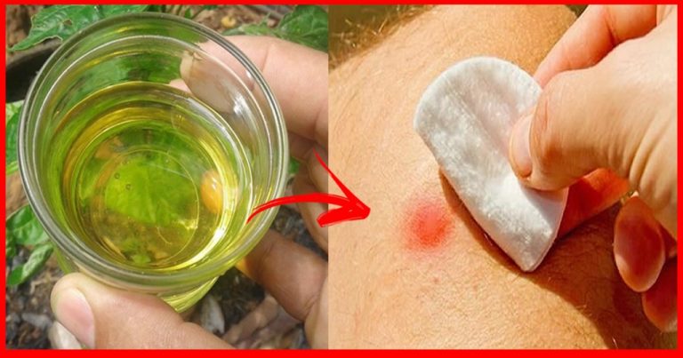 8 Remédios Caseiro Para Tratar o Furúnculo! | Cura Natural