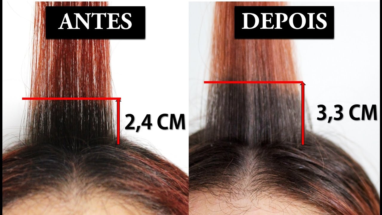 Faça o cabelo crescer usando esses 7 remédios caseiros