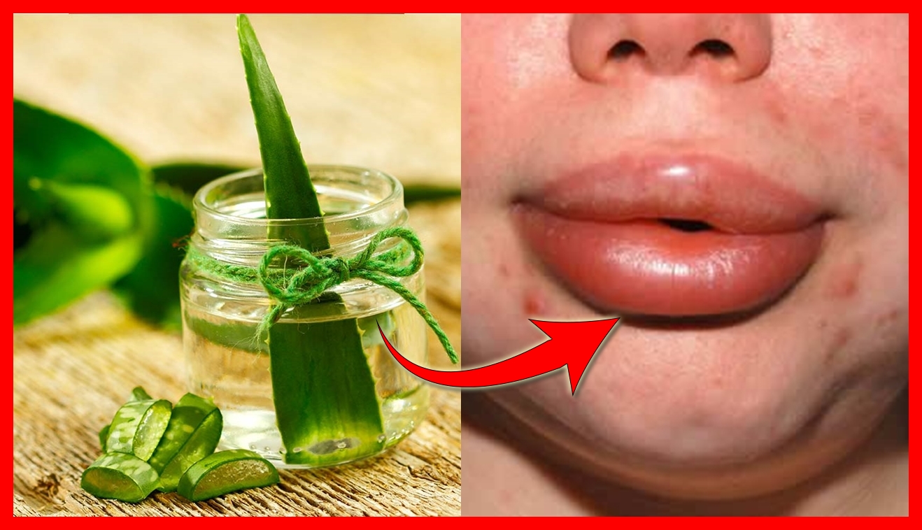 remedios caseiros para remover o inchaço nos labios