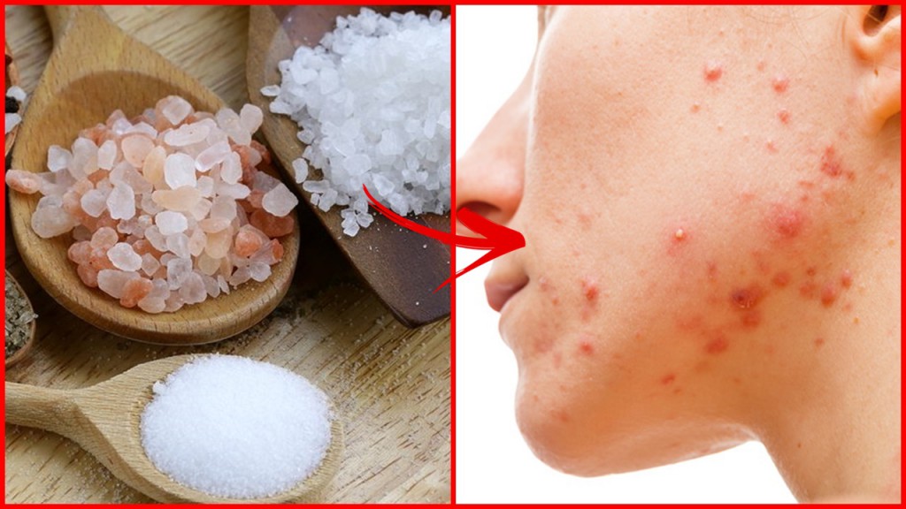 sal do mar para tratar acne
