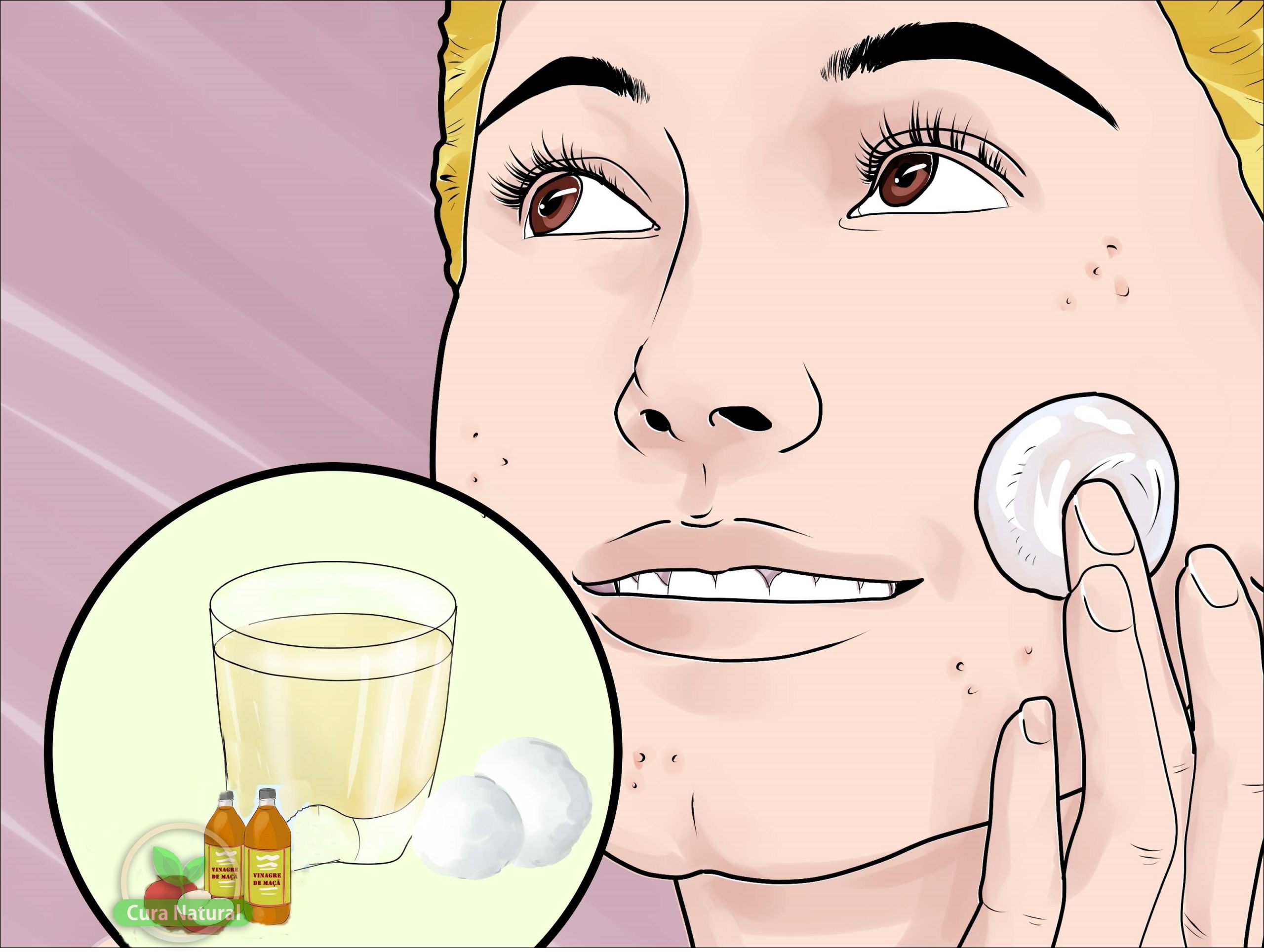 receitas com vinagre de maça para tratar acne