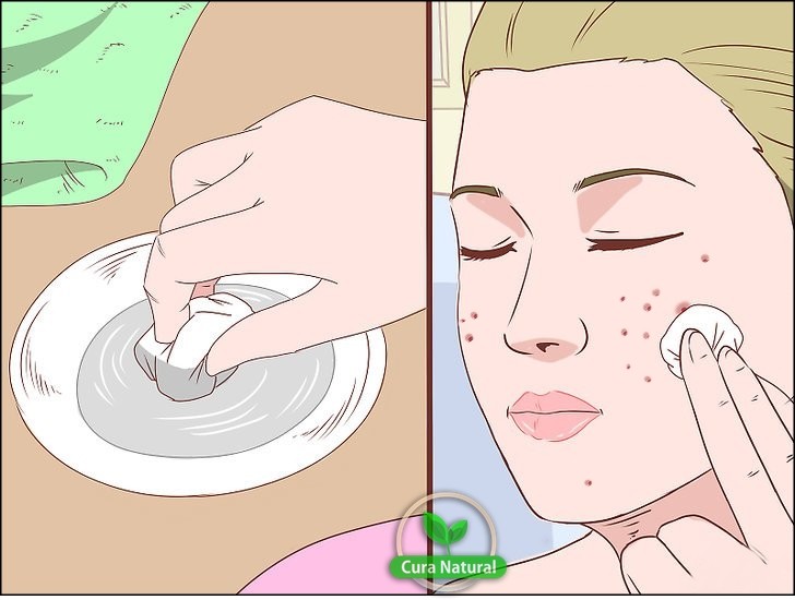oleos essenciais para eliminar acne